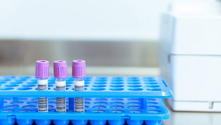 Vacutainer tubes with EDTA additive in laboratory rack for blood collection and analysis