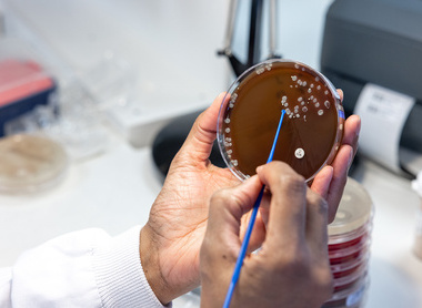 Petri dish sample for Kiestra machine in a microbiology lab