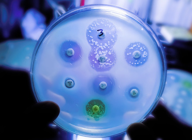 Antimicrobial susceptibility testing in petri dish