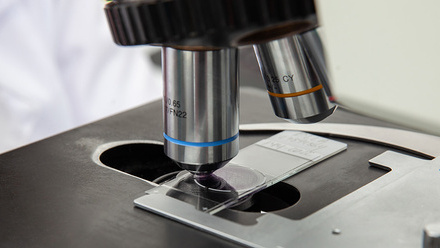 Scientist looking at liquid based cytology pap smear samples through a microscope