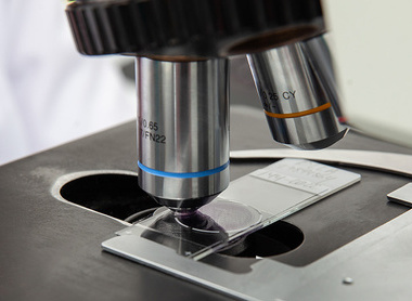 Scientist looking at liquid based cytology pap smear samples through a microscope