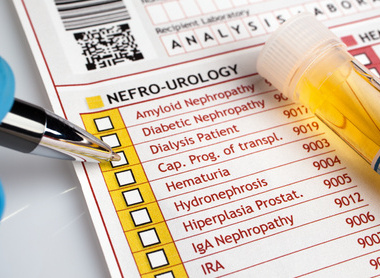 Doctor writing a report of analysis of urine for a patient