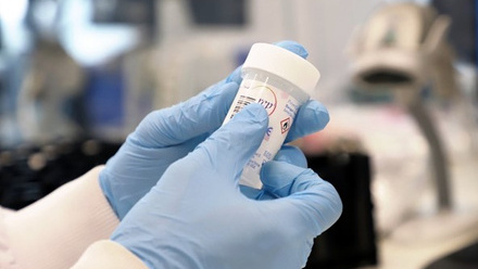 Sample pot being held at sample reception at Cervical Screening London (CSL) team at Health Services Laboratories