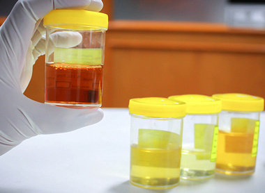 Urine trouble banner