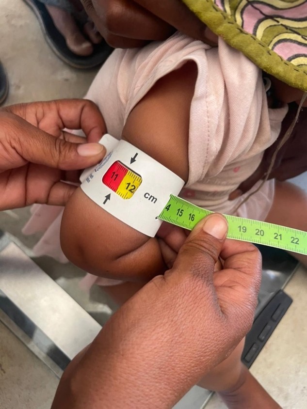 Measuring the Mean Upper Arm Circumference (MUAC) of a child