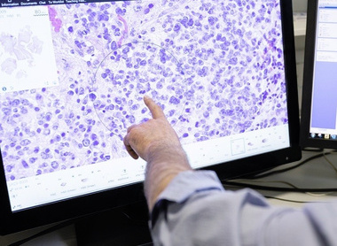 Neuropathology slide on computer.jpg