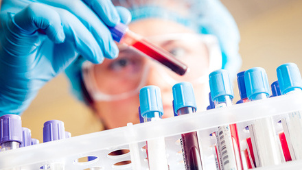 Female scientist handling blood sample tubes resized.jpg