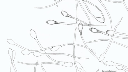 Incredible You_Forensic pathology: Sperm cells