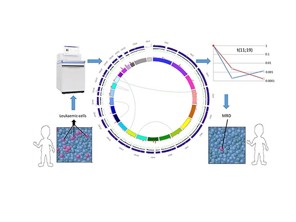 Figure 1: Application of whole genome sequencing in practice.  This schematic shows the application of a whole genome sequence from a patient’s leukaemia. The central plot (a Circos plot) is used to 