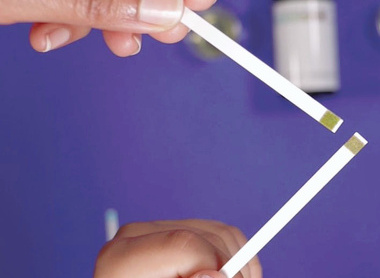 Person holding urinalysis strips to test urine samples