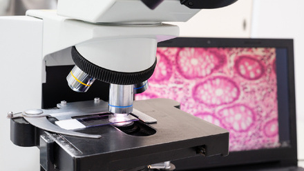 Microscope and slide with a computer screen behind