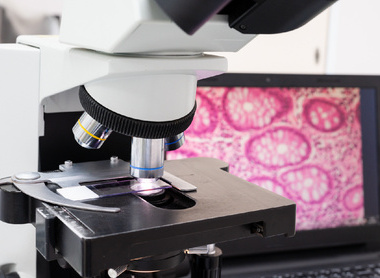Microscope and slide with a computer screen behind