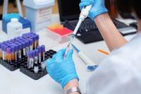 Blood testing in laboratory