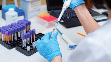 Blood testing in a laboratory