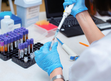 Blood testing in laboratory.jpg