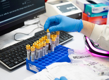 Sample tubes being handled in a virology laboratory