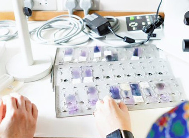 Two pathologists looking at slides on a desk