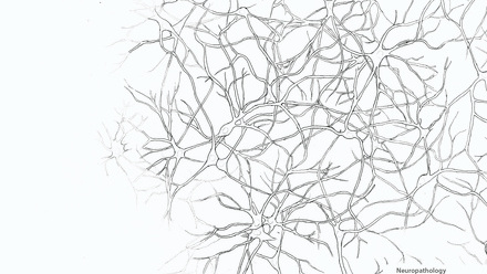 Incredible You_Neuropathology: Brain cells