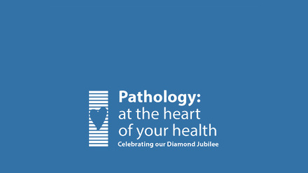 Diamond Jubilee Featured.jpg