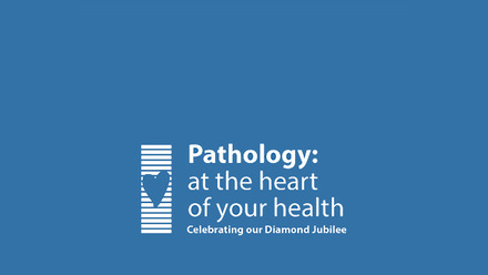 Diamond Jubilee Featured.jpg