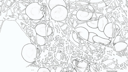 Incredible you_Haematology: Blood clot