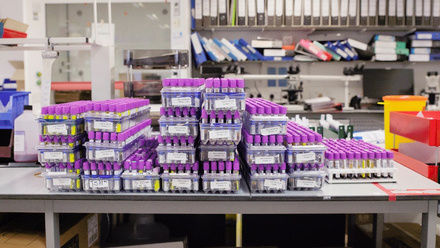 Sample tubes with office background