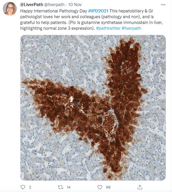 X post celebrating International Pathology Day 2021