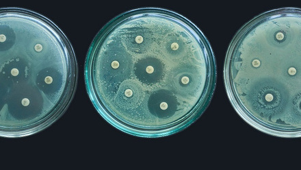 Bacteria on 3 agar plates in a row