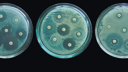 Bacteria on 3 agar plates in a row