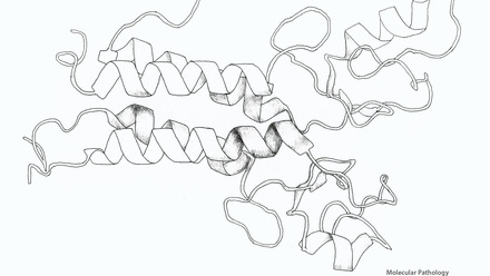Incredible You_Molecular pathology: BRCA1 protein