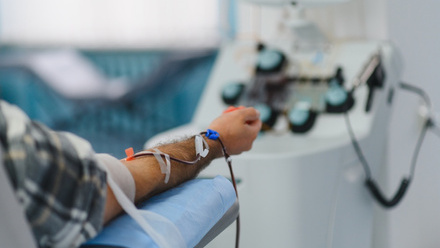 Person-undergoing-apheresis-procedure-donating-blood-plasma-in-a-hospital-setting-with-medical-equipment 1