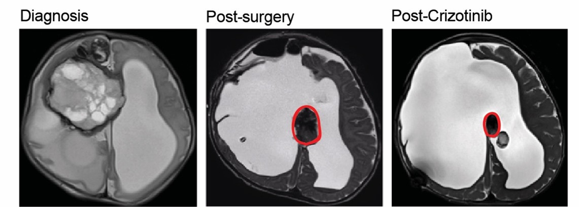 MRI scans