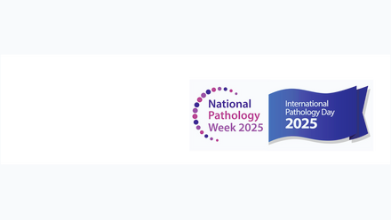 New version of NPW IPD for news postv2.png