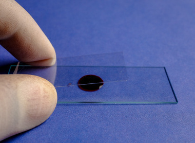 Preparing blood smear on slide for microscopic examination