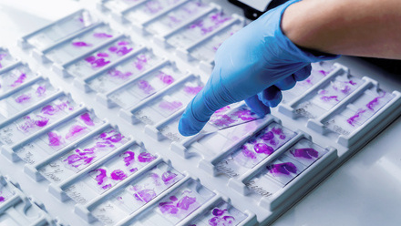 Gloved hand holding glass histopathology slides