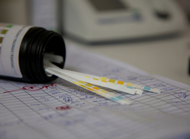 Urine strip tests