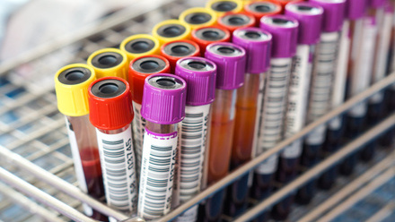 Collection of blood samples in a rack
