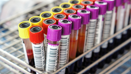 Collection of blood samples in a rack