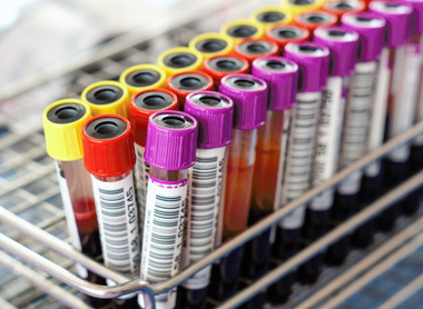 Collection of blood samples in a rack