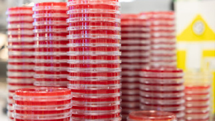 Agar plates in a microbiology lab