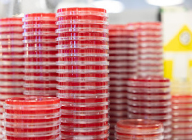 Agar plates in a microbiology lab