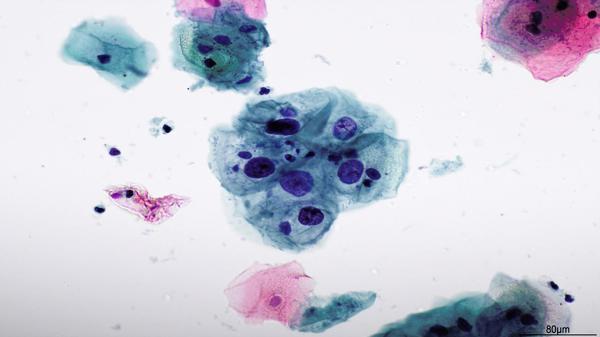 Cytopathology slide