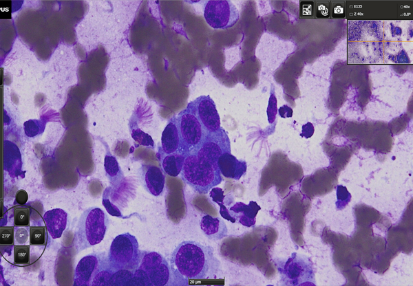 Cytology slide