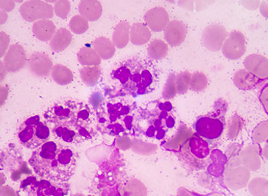 Cytopathology slide showing cells