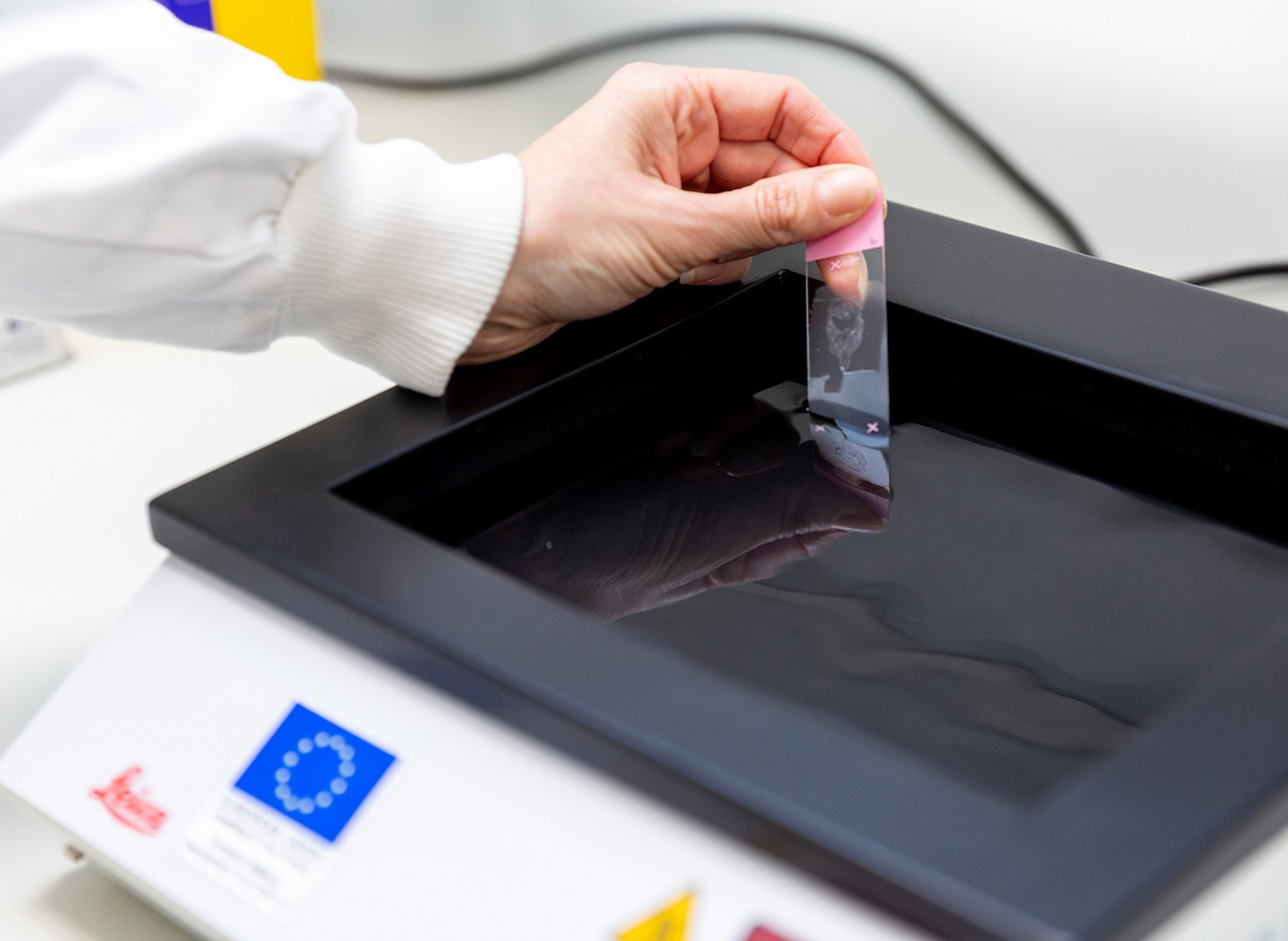 Liverpool Ocular Pathology Services slide