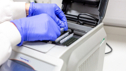 Liverpool ocular pathology molecular science