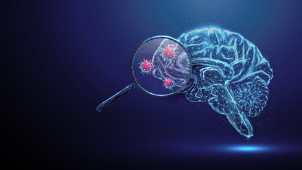 Brain with virus abstract image.jpg