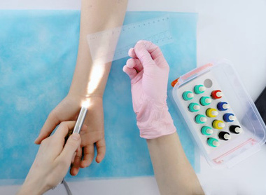 Doctor doing skin allergy test.jpg