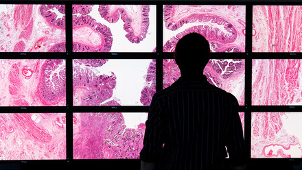 Digital pathology display partial image.jpg