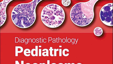 Paediatric neoplasms.jpg